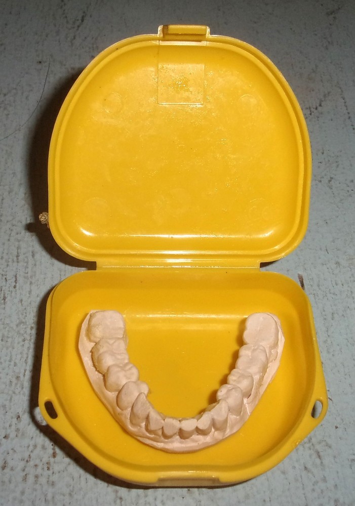 Plaster Lower Jaw Denture Cast for False Teeth Prop Creepy Decor