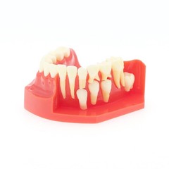 Teeth Typodont Dental Model – Eruption Development, Deciduous Teeth, Dental Educ