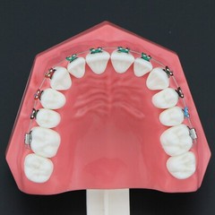 US Dental Typodont Teeth Model with Orthodontic Brackets Brushing