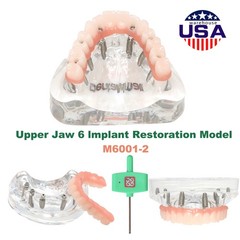 US Dental Overdenture/Implant/Orthodontic Typodont Ortho Training Teaching Model