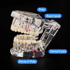 Dental Teaching Tool with Removable Teeth