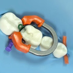 Dental Matrix Bands Ring Sectional Matrice Clamp Fit Garrison Palodent V3 System