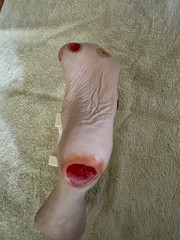 VATA Wilma Wound Foot Teaching Model