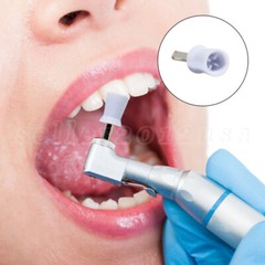 100 Pcs Polishing Cups Dental Rubber Prophy Tooth Polisher Brushes Kit white