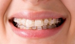 J&J Ortho™ Orthodontic White Coated Arch Wire Ovoid / Natural Optional (1/pk)