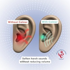 Flare Calmer | Ear Plugs Alternative | Daily Noise Relief | Sound Sensitivity…