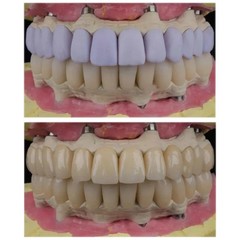 US C14 Dental Lithium Dislicate Block For Sirona Cerec IPS e.max CAD CEREC Block