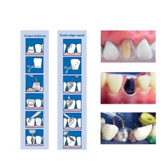 Dental Preformed Crown Resin Temporary Pre-corona Transparent Anterior 1.910