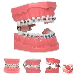 US Dental Typodont Ortho Teeth Model With Metal Braces for Brushing Practice