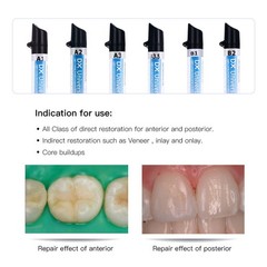 Dental Universal Light Cure Composite Resin/Etching Gel/Bonding Adhesive