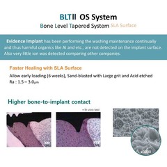 Evidence Bone Level Tapered Fixture Int Hex 2.1/2.5mm Korea Made