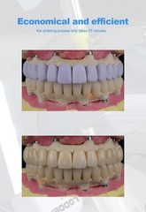 US C14 Dental Lithium Dislicate Block For Sirona Cerec IPS e.max CAD CEREC Block