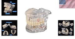 Dental Teaching Tool with Removable Teeth
