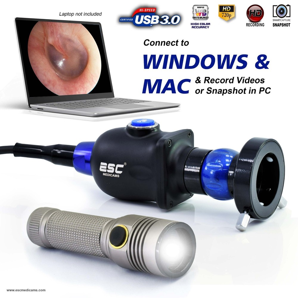 USB Endoscopy Camera HD w/ Portable Cold LED Light Source for Rigid Endoscopes