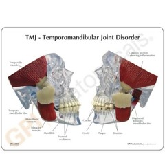 TMJ – Temporomandibular Joint Anatomical Model GPI LFA #2880 SEE VIDEO