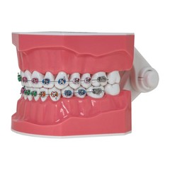 US Dental Typodont Teeth Model with Orthodontic Brackets Brushing
