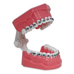 US Dental Typodont Ortho Teeth Model With Metal Braces for Brushing Practice