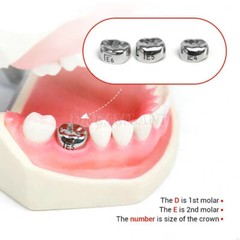 48 ASSORTED PRIMARY MOLAR STAINLESS STEEL CROWNS – COMPLETE KIT