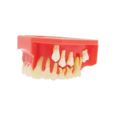 Teeth Typodont Dental Model – Eruption Development, Deciduous Teeth, Dental Educ