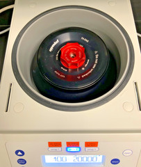 Eppendorf 5425 Benchtop Microcentrifuge w/FA-24×2 Fixed Angle Rotor 15K RPM 120V