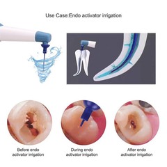 NSK Style Dental Fiber Optic LED E-generator High Speed Handpiece Turbine 4 HOLE