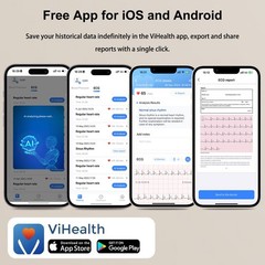 ECG EKG Monitor Heart Monitor with free AI ECG Analysis 30s/60s/5min Recording