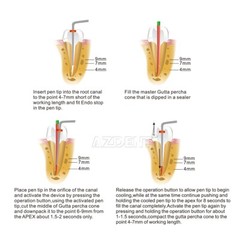 AZDENT Dental Endo Obturation System Heated Pen/Gutta Percha Cutter/Endo Motor