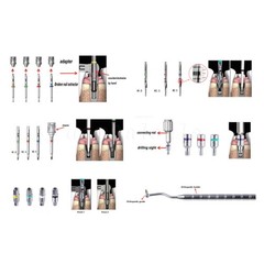 Broken Screw Removal Kit Implant Remover Rescue Tool Universal NeoBiotech OR