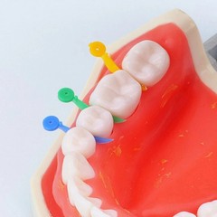 Pack of 200 Dental Tooth Gap Wedges with End Circular Holes Plastic Wedge 4 Size