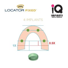 LOCATOR FIXED Genuine Insert for Four Unit, Green (2-Pack)