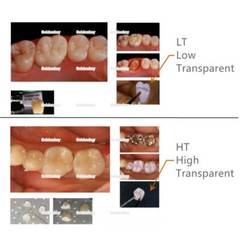 Dental Glass Ceramic CAD CAM B40 Blocks CEREC Lithium Disilicate HT LT XA1/2/3