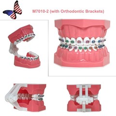 US Dental Overdenture/Implant/Orthodontic Typodont Ortho Training Teaching Model