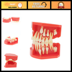 Teeth Typodont Dental Model – Eruption Development, Deciduous Teeth, Dental Educ