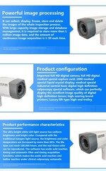 High Quality Digital Colposcopy w/ LCD Screen & Diagnostic Software