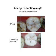 Dental Wireless Oral Viewer Intraoral Camera 1080p HD Intra Oral Camera