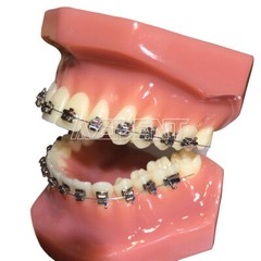 Dental Orthodontic Self Ligating Brackets Active Passive Roth MBT 022 Hooks 345