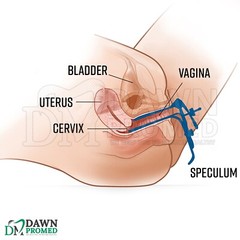 4 Pcs Blue Coated Graves Vaginal Speculum S, M, L, XL OB/GYN Inst German Grade