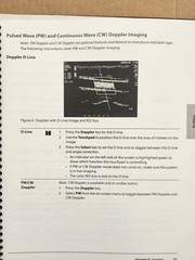 SonoSite MicroMaxx PORTABLE ULTRASOUND with C11e/P17/ECG probes, tested, due2025