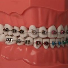 US 1:1 Dental Orthodontic Teeth Model Typodont Demonstration Model with Brackets