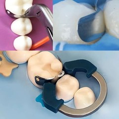 Dental Matrix Bands Ring Sectional Matrice Clamp Fit Garrison Palodent V3 System