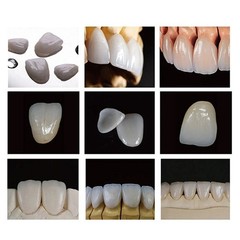 C14 Glass Ceramic Blocks HT LT Lithium Disilicate CAD/CAM Cerec Blocks 5Pcs/Box