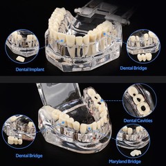 Dental Teaching Tool with Removable Teeth