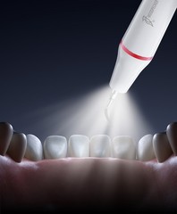 Woodpecker Ultrasonic Scaler UDS-A LED Dental Scaling Perio Endo Treatment
