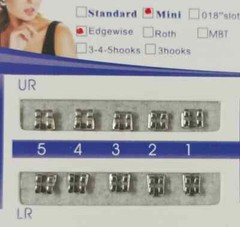 Dental Orthodontics MIM Monoblock Brackets Mini Edgewise 022 no hooks Mesh Base