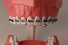 US 1:1 Dental Orthodontic Teeth Model Typodont Demonstration Model with Brackets