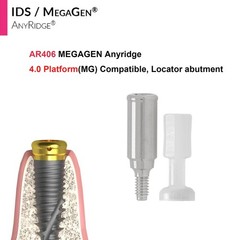 Implant Fit Zest Locator Abutment Hiossen/Nobel/Zimmer/GM/MegaGen /Straumann