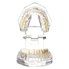 Dentalmall Dental Oral Typodont Model Implant Standard Size, Clear