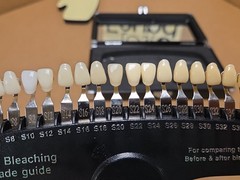 R-20 Bleaching Shade Guide Professional Teeth Whitening Shade Guide