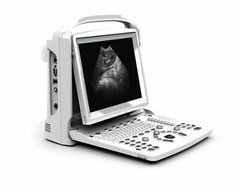 Chison ECO3, MSK, Ultrasound Machine Linear Array Probe, 3 Year Warranty