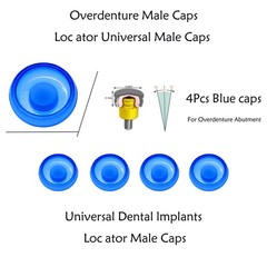 Dental Overdenture Implant Locator Abutment Retention Caps Male Cap Inserts Set